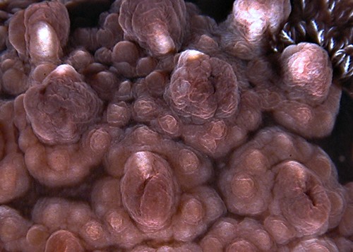 Dendrodoris carbunculosa: tubercle detail