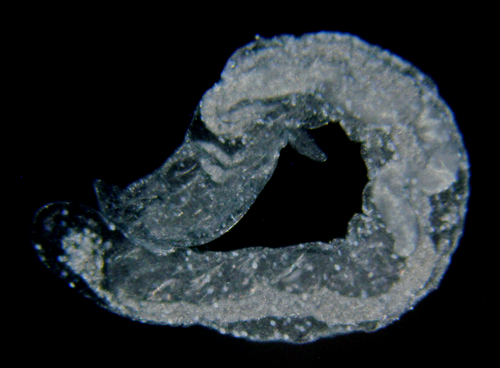 Microhedyle sp. #1