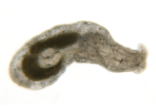Pontohedyle sp. #1
